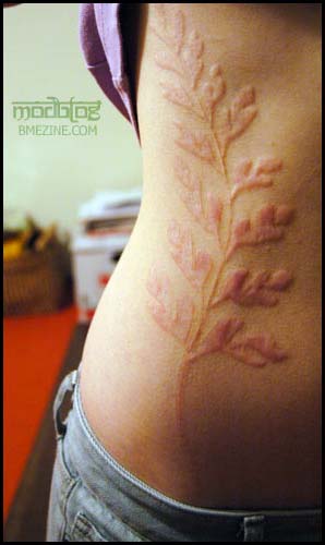 fern leaf scarification healed